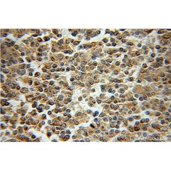 DCTN2 Rabbit Polyclonal Antibody (10030-2-AP)