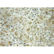 KPNB1 Rabbit Polyclonal Antibody (10077-1-AP)
