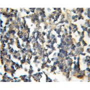 TRIM32 Rabbit Polyclonal Antibody (10326-1-AP)