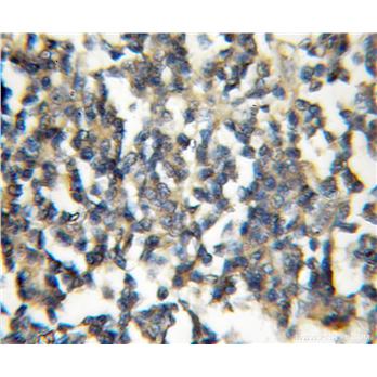 TRIM32 Rabbit Polyclonal Antibody (10326-1-AP)