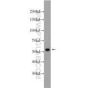 VIM Rabbit Polyclonal Antibody (10366-1-AP)