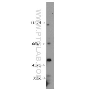 NFYC Rabbit Polyclonal Antibody (10129-2-AP)