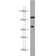GTF2F1 Rabbit Polyclonal Antibody (10093-2-AP)