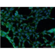 DMAP1 Rabbit Polyclonal Antibody (10411-1-AP)