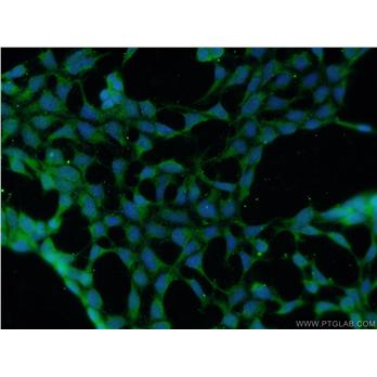 DMAP1 Rabbit Polyclonal Antibody (10411-1-AP)