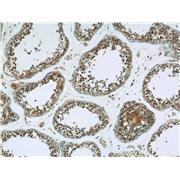 PRKAG1 Rabbit Polyclonal Antibody (10290-1-AP)