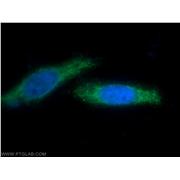 BIRC5 Rabbit Polyclonal Antibody (10508-1-AP)