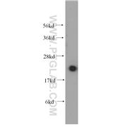 UBE2I Rabbit Polyclonal Antibody (10224-1-AP)