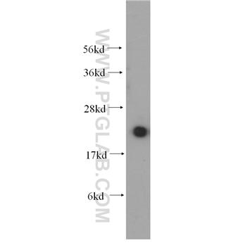 UBE2I Rabbit Polyclonal Antibody (10224-1-AP)