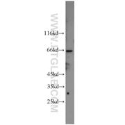 NXF1 Rabbit Polyclonal Antibody (10328-1-AP)