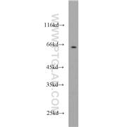 PCTK1 Rabbit Polyclonal Antibody (10102-1-AP)