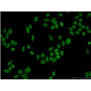 DDB2 Rabbit Polyclonal Antibody (10431-1-AP)