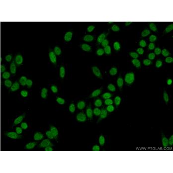 DDB2 Rabbit Polyclonal Antibody (10431-1-AP)
