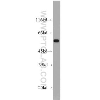 IFNGR2 Rabbit Polyclonal Antibody (10266-1-AP)