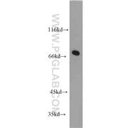 WBP11 Rabbit Polyclonal Antibody (10316-1-AP)