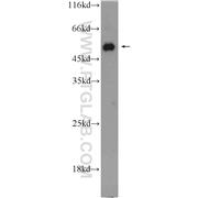 ACVR1B Rabbit Polyclonal Antibody (10086-1-AP)