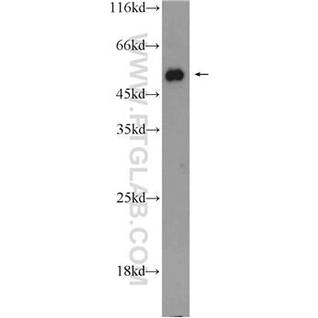 ACVR1B Rabbit Polyclonal Antibody (10086-1-AP)