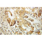 PYCARD Rabbit Polyclonal Antibody (10500-1-AP)