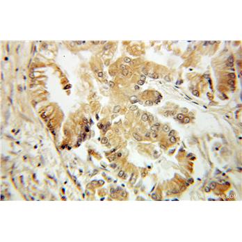 PYCARD Rabbit Polyclonal Antibody (10500-1-AP)