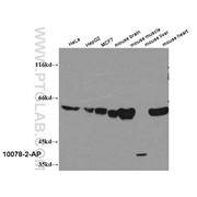 PKM2 Rabbit Polyclonal Antibody (10078-2-AP)