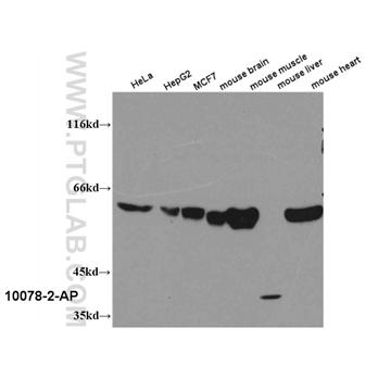 PKM2 Rabbit Polyclonal Antibody (10078-2-AP)