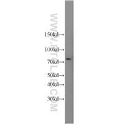 SUMO1 Rabbit Polyclonal Antibody (10329-1-AP)