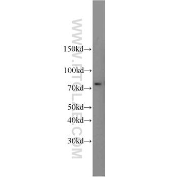 SUMO1 Rabbit Polyclonal Antibody (10329-1-AP)