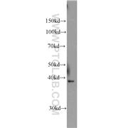 COPS4 Rabbit Polyclonal Antibody (10464-1-AP)