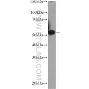 TBRG4 Rabbit Polyclonal Antibody (10177-2-AP)