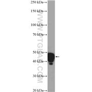 GNAS Rabbit Polyclonal Antibody (10150-2-AP)