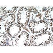 MAGEC2 Rabbit Polyclonal Antibody (10280-1-AP)