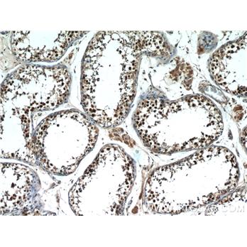 MAGEC2 Rabbit Polyclonal Antibody (10280-1-AP)