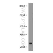 ARHGDIA Rabbit Polyclonal Antibody (10509-1-Ig)