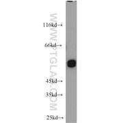 UGP2 Rabbit Polyclonal Antibody (10391-1-AP)