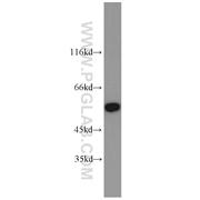 PDLIM7 Rabbit Polyclonal Antibody (10221-1-AP)