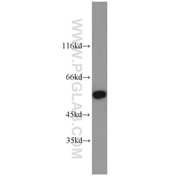 PDLIM7 Rabbit Polyclonal Antibody (10221-1-AP)