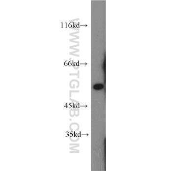 ALDH7A1 Rabbit Polyclonal Antibody (10368-1-AP)