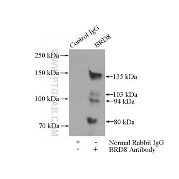 BRD8 Rabbit Polyclonal Antibody (10476-1-AP)