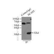BCAS2 Rabbit Polyclonal Antibody (10414-1-AP)