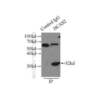 BCAS2 Rabbit Polyclonal Antibody (10414-1-AP)
