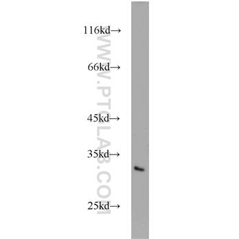 MEA1 Rabbit Polyclonal Antibody (10267-1-AP)