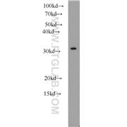 CLTB Rabbit Polyclonal Antibody (10455-1-AP)