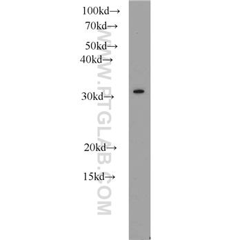 CLTB Rabbit Polyclonal Antibody (10455-1-AP)