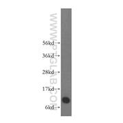 S100A6 Rabbit Polyclonal Antibody (10245-1-AP)