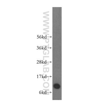 S100A6 Rabbit Polyclonal Antibody (10245-1-AP)
