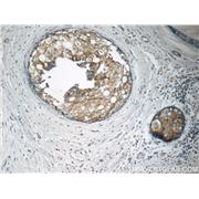 MATK Rabbit Polyclonal Antibody (10082-2-AP)