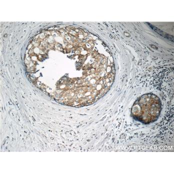 MATK Rabbit Polyclonal Antibody (10082-2-AP)