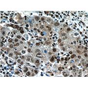 NFKB2 Rabbit Polyclonal Antibody (10409-2-AP)