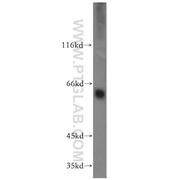 MAOA Rabbit Polyclonal Antibody (10539-1-AP)