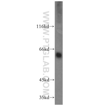 MAOA Rabbit Polyclonal Antibody (10539-1-AP)